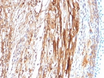 CRYAB Antibody