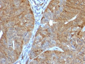 AKR1B1 Antibody / Aldose reductase