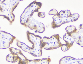 Recombinant MMP3 Antibody