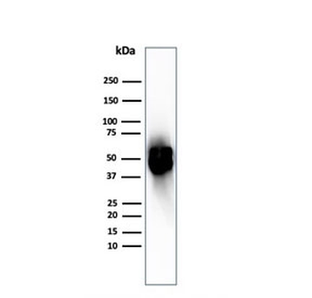 Recombinant Thymidine Phosphorylase Antibody / PD-ECGF