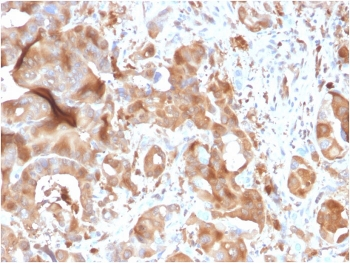 FABP5 Antibody