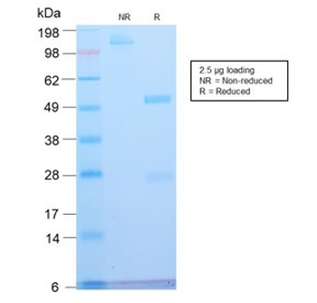 ATRX Antibody / RAD54
