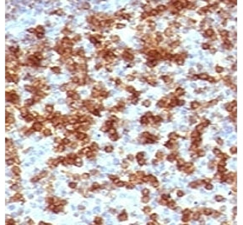 PD-1 Antibody
