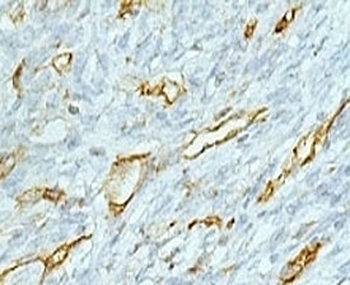 CD31 Antibody