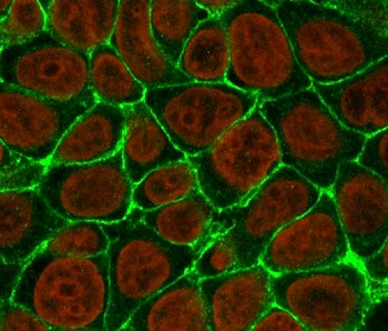 EpCAM Antibody