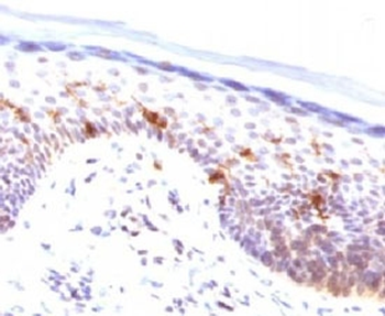 CD1a Antibody