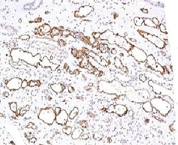 C4d Antibody Complement 4d