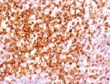 CD6 Antibody