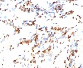 p27 Antibody / p27Kip1
