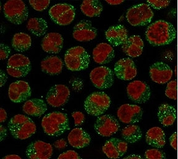 CD79a Antibody