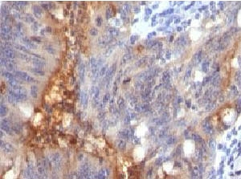 Recombinant Secretory Component Glycoprotein Antibody / ECM1