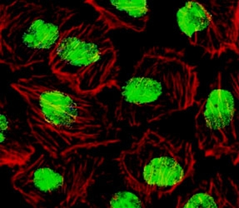 SUMO1 Antibody