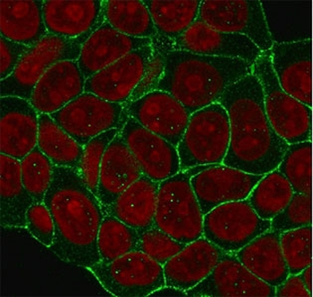 HER2 Antibody