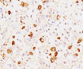 FSH-beta Antibody