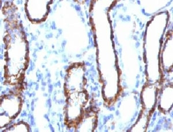 Cadherin 16 Antibody