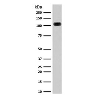 Cadherin 16 Antibody