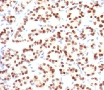 TTF-1 Antibody / NKX2.1