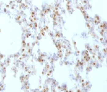 TTF-1 Antibody / NKX2.1
