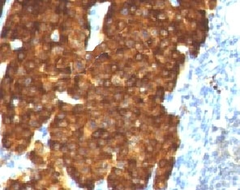 Chromogranin A Antibody
