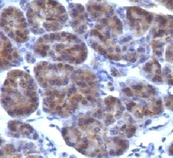 Golgi Antibody / Golgi apparatus protein 1 / GLG1