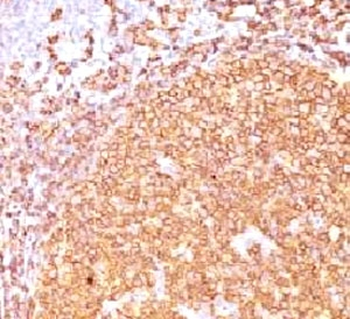 CD20 Antibody