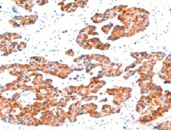 Basic Cytokeratin Antibody