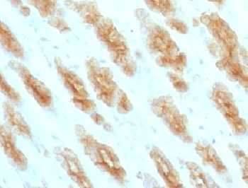 Basic Cytokeratin Antibody