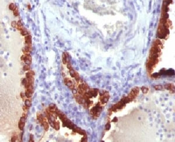 Cytokeratin 7 Antibody