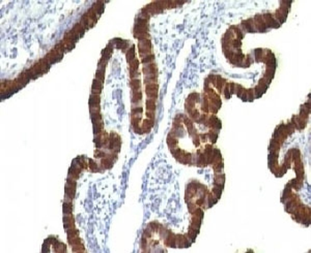 Cytokeratin 7 Antibody