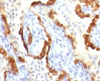 Cytokeratin 18 Antibody
