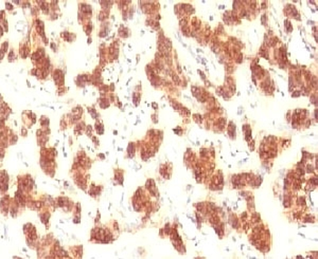 Cytokeratin 18 Antibody