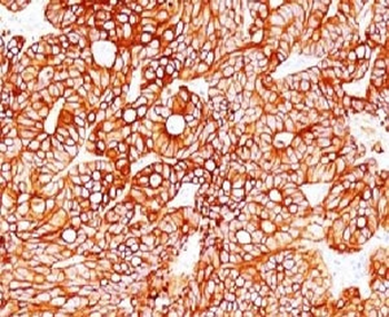 Cytokeratin 18 Antibody