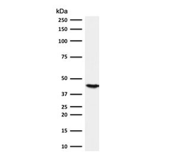 Cytokeratin 18 Antibody
