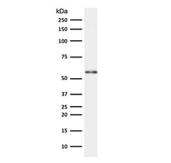 Keratin 10 Antibody / KRT10