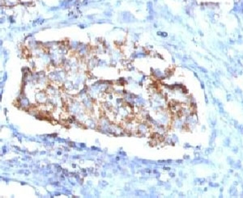 HSP60 Antibody / HSPD1