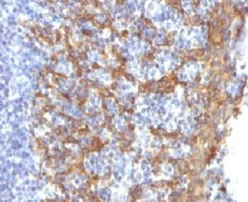 Keratin 14 Antibody (K14)