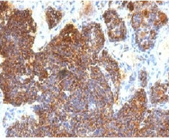 Parathyroid Hormone Antibody