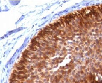 Cytokeratin 17 Antibody