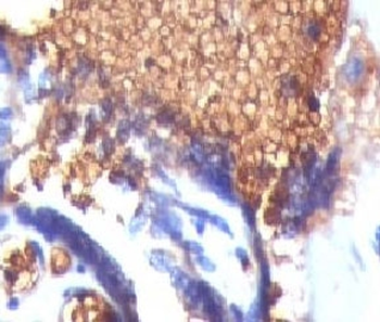Glycophorin A Antibody