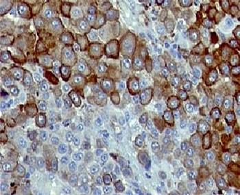NGF Receptor Antibody / p75NTR / CD271