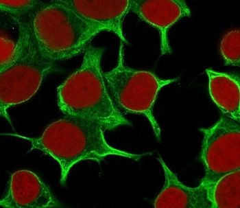 Keratin 19 Antibody