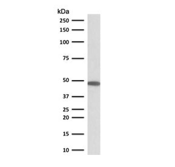 Keratin 19 Antibody