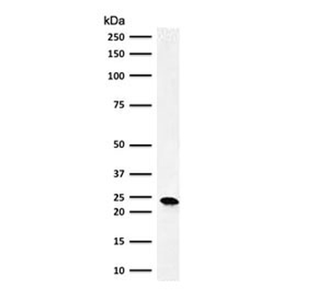 Bcl-2 Antibody