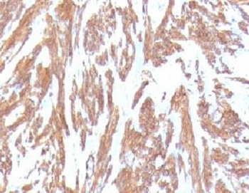 Alpha Actin Antibody / ACTA2 (smooth muscle)