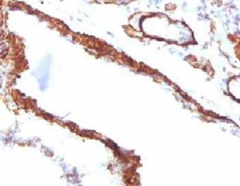 Alpha Actin Antibody / ACTA2 (smooth muscle)
