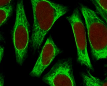 Alpha Actin Antibody / ACTA2 (smooth muscle)
