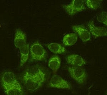 Fascin Antibody