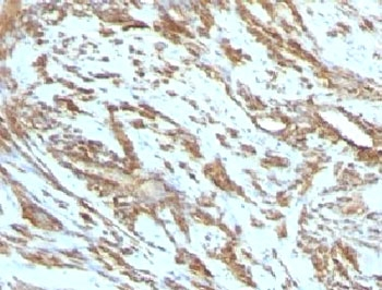 Muscle Actin Antibody (pan)