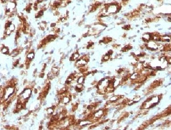 Muscle Actin Antibody (pan)