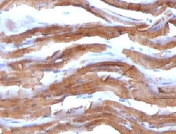 Muscle Actin Antibody (pan)